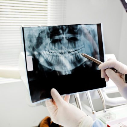 Dentist holding xray film of jaw and teeth